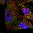 Immunofluorescent staining of human cell line U-251 MG shows localization to vesicles.