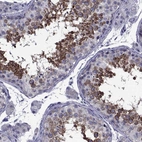 Immunohistochemical staining of human testis shows high expression.
