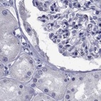 Immunohistochemical staining of human kidney using Anti-GKAP1 antibody HPA035118.