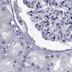 Immunohistochemical staining of human kidney using Anti-GKAP1 antibody HPA035118.