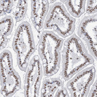 Immunohistochemical staining of human small intestine shows moderate nuclear positivity in glandular cells.