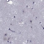 Immunohistochemical staining of human cerebral cortex using Anti-GKAP1 antibody HPA035118.