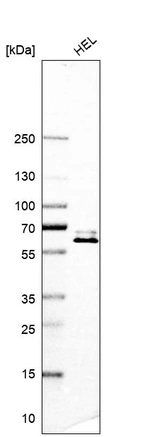 Western blot analysis in human cell line HEL.