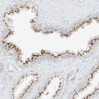 Immunohistochemical staining of human prostate shows strong positivity in cytoplasm granular in glandular cells.