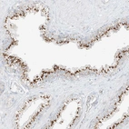 Immunohistochemical staining of human prostate shows strong positivity in cytoplasm granular in glandular cells.