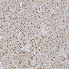 Immunohistochemical staining of human pancreas shows moderate positivity in cytoplasm granular in exocrine glandular cells.
