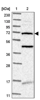 Lane 1: Marker [kDa] 230, 130, 95, 72, 56, 36, 28, 17, 11_br/_Lane 2: Human cell line RT-4