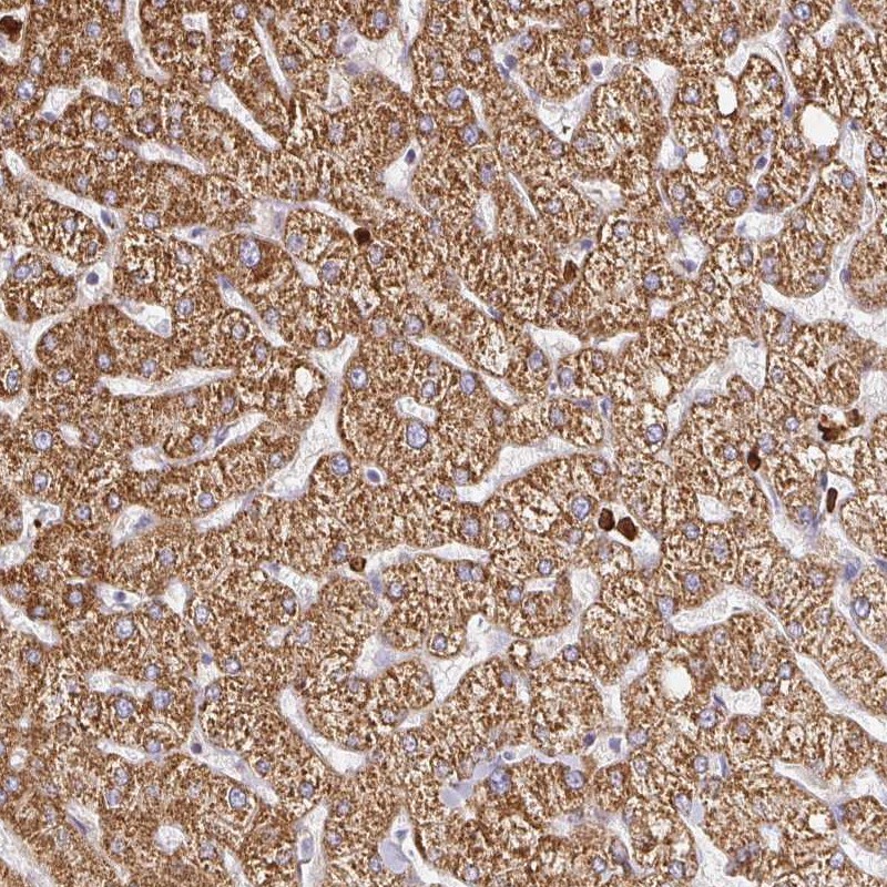 Anti-PDPK1 Antibody