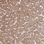 Anti-PDPK1 Antibody
