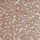 Anti-PDPK1 Antibody