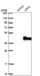 Anti-UPP2 Antibody