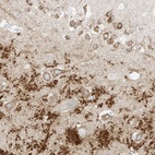 Anti-RFTN2 Antibody