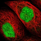 Immunofluorescent staining of human cell line A-431 shows localization to nucleoplasm.