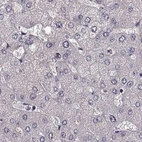 Immunohistochemical staining of human liver using Anti-GRK1 antibody HPA035200.