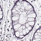 Immunohistochemical staining of human colon using Anti-GRK1 antibody HPA035200.