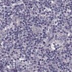 Immunohistochemical staining of human lymph node using Anti-GRK1 antibody HPA035200.
