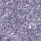 Immunohistochemical staining of human lymph node using Anti-GRK1 antibody HPA035200.