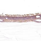 Immunohistochemical staining of human eye, retina using Anti-GRK1 antibody HPA035200.