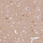 Immunohistochemical staining of human cerebral cortex shows weak cytoplasmic positivity in neurons.