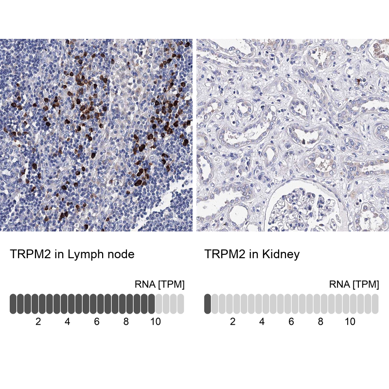 Anti-TRPM2 Antibody