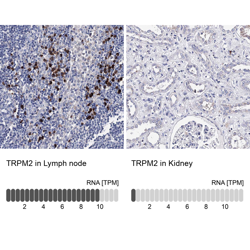 Anti-TRPM2 Antibody