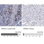 Anti-TRPM2 Antibody