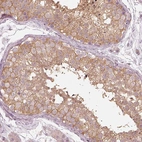 Immunohistochemical staining of human testis shows weak cytoplasmic positivity in cells in seminiferous ducts.