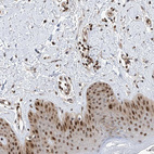 Immunohistochemical staining of human skin shows strong nuclear positivity in squamous epithelial cells.