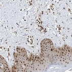 Immunohistochemical staining of human skin shows strong nuclear positivity in squamous epithelial cells.