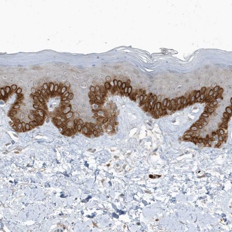 Anti-PARD3B Antibody