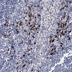 Immunohistochemical staining of human lymph node shows high expression.
