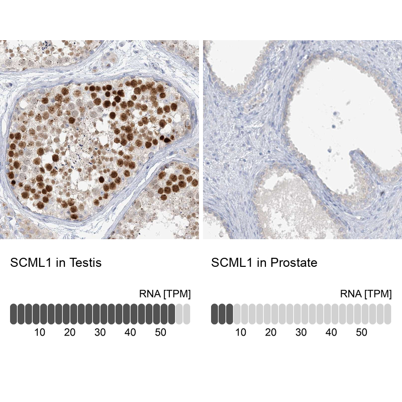 Anti-SCML1 Antibody