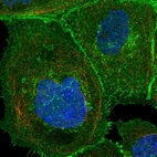 Immunofluorescent staining of human cell line A-431 shows localization to plasma membrane.