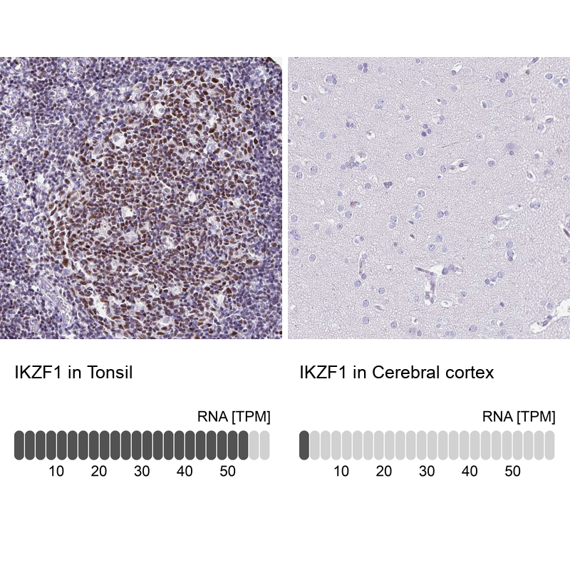Anti-IKZF1 Antibody