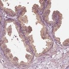 Immunohistochemical staining of human prostate shows weak cytoplasmic positivity in glandular cells.