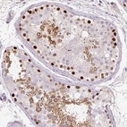 Immunohistochemical staining of human testis shows strong nuclear/nuclear membranous positivity in subset of cells in seminiferous ducts.