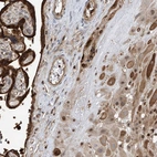 Immunohistochemical staining of human placenta shows strong nuclear-cytoplasmic positivity in decidual cells and trophoblastic cells.