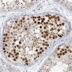 Immunohistochemical staining of human testis shows high expression.