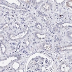 Immunohistochemical staining of human kidney shows low expression as expected.