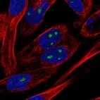 Immunofluorescent staining of human cell line RH-30 shows localization to nucleoli.