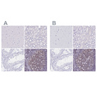Immunohistochemical staining of human cerebral cortex, kidney, testis and tonsil using Anti-IKZF1 antibody HPA035221 (A) shows similar protein distribution across tissues to independent antibody HPA035222 (B).