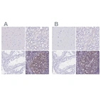 Immunohistochemical staining of human cerebral cortex, kidney, testis and tonsil using Anti-IKZF1 antibody HPA035221 (A) shows similar protein distribution across tissues to independent antibody HPA035222 (B).