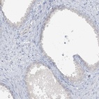 Immunohistochemical staining of human prostate shows low expression as expected.