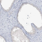 Immunohistochemical staining of human prostate shows low expression as expected.