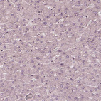 Immunohistochemical staining of human liver shows no positivity in hepatocytes as expected.