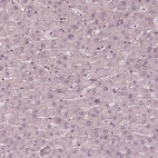 Immunohistochemical staining of human liver shows no positivity in hepatocytes as expected.