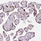 Immunohistochemical staining of human placenta shows strong nuclear/nuclear membranous positivity in trophoblastic cells.