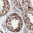 Immunohistochemical staining of human testis shows strong nuclear positivity in cells in seminiferous ducts.