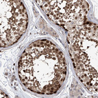 Anti-DNAJC9 Antibody