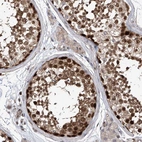 Immunohistochemical staining of human testis shows strong nuclear positivity in cells in seminiferous ducts.